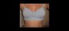 Breast Augmentation Recovery Diary case #26662 slider thumbnail