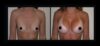 Breast Augmentation case #26826 slider thumbnail