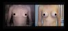 Breast Augmentation case #26774 slider thumbnail