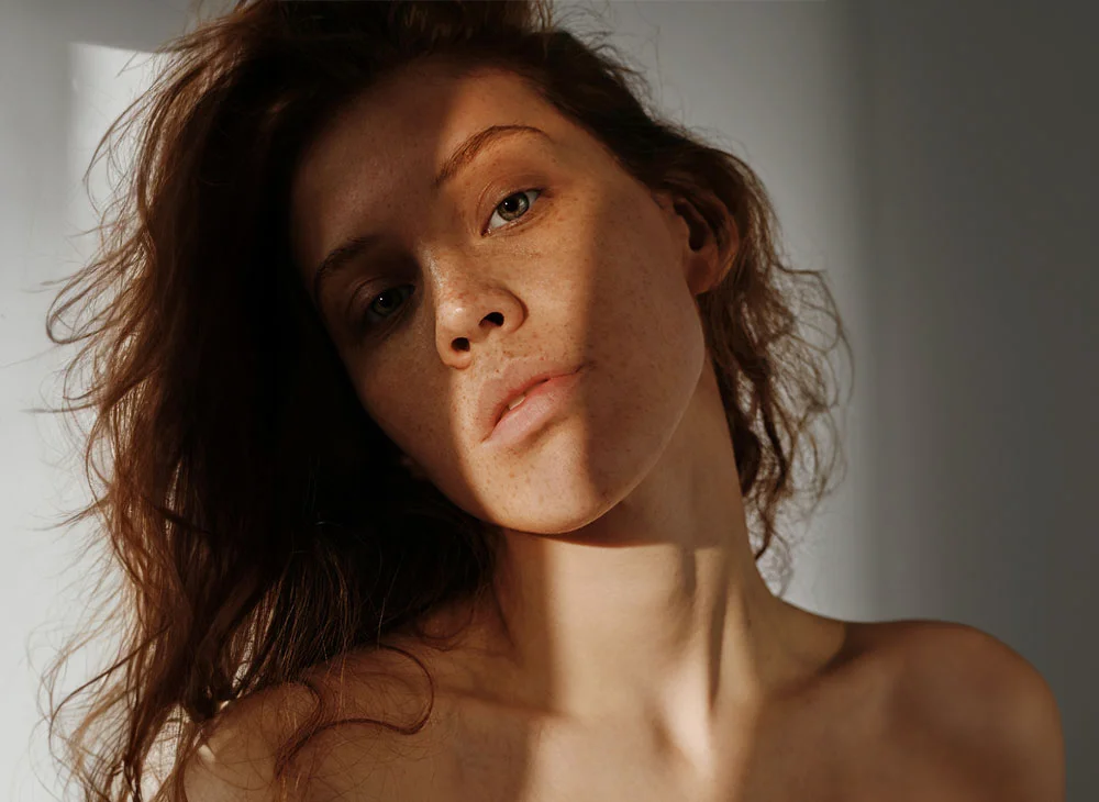 Aa woman with red wavy hair, light shining on her face, showing her freckles - Non-Surgical Concerns Procedure in Toronto, ON