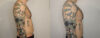 Pectoral Implants case #35777 slider thumbnail